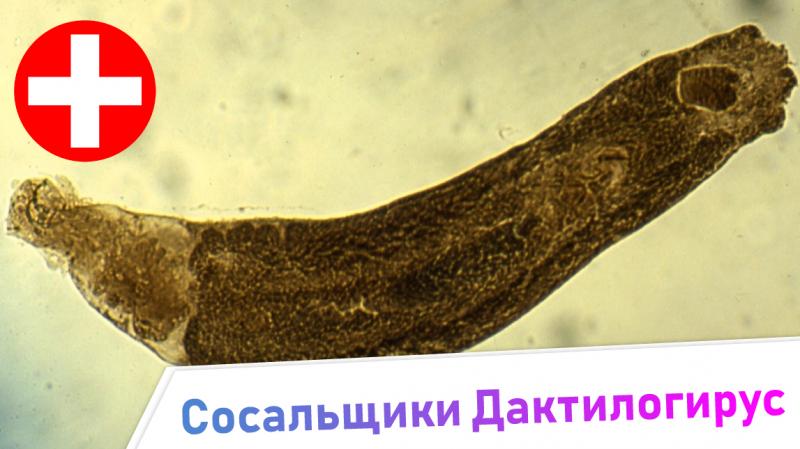 сосальщики дактилогирус - симптомы и лечение. жизненный цикл паразита